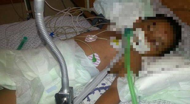 non voleva fare i compiti il padre lo picchia col tuo dell'aspirapolvere fino a mandarlo in coma