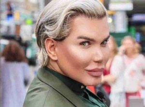 Rodrigo Alves, nuovo intervento chirurgico per il 'Ken Umano': ecco che cosa ha cambiato