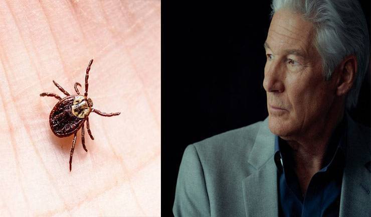 richard gere malattia di Lyme