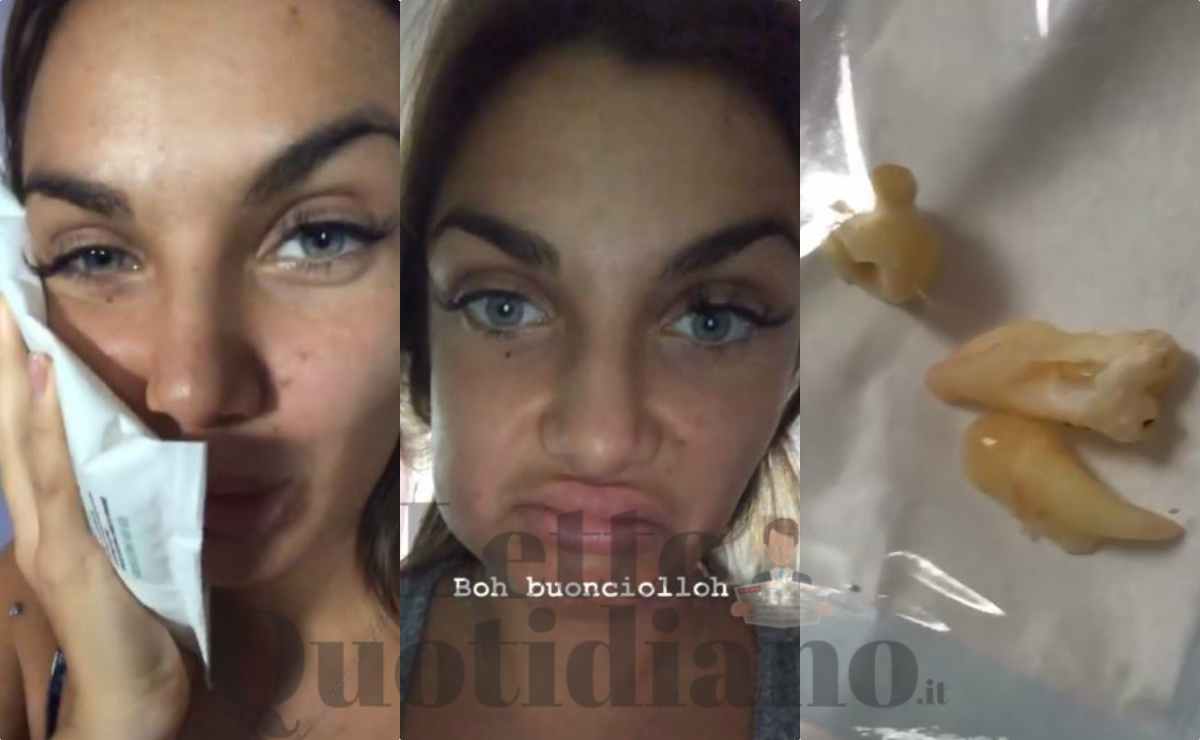 elettra lamborghini si è operata al dente del giudizio