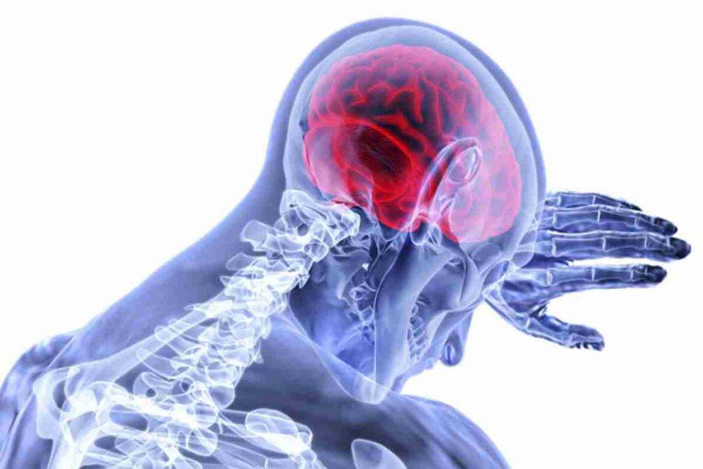 Un mal di testa è segno di un tumore al cervello? Ecco la verità