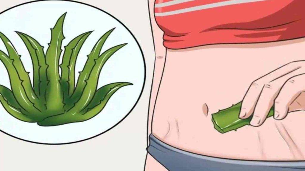 Gelo all'aloe vera per togliere le smagliature: come farlo in casa