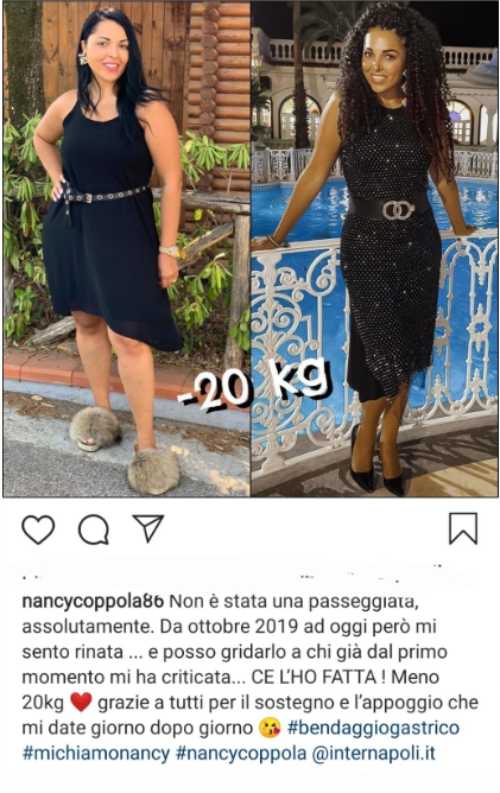 Nancy Coppola prima e dopo