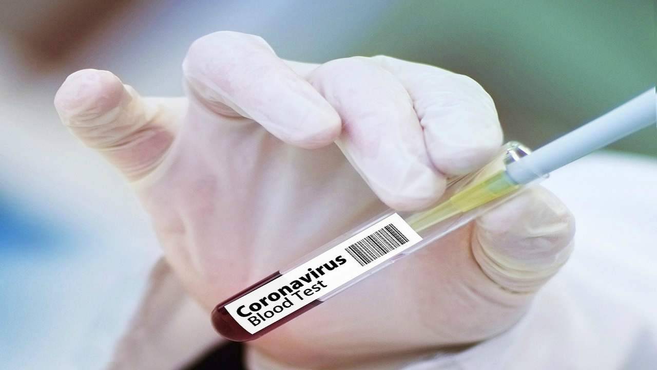 coronavirus in Francia zone rosse