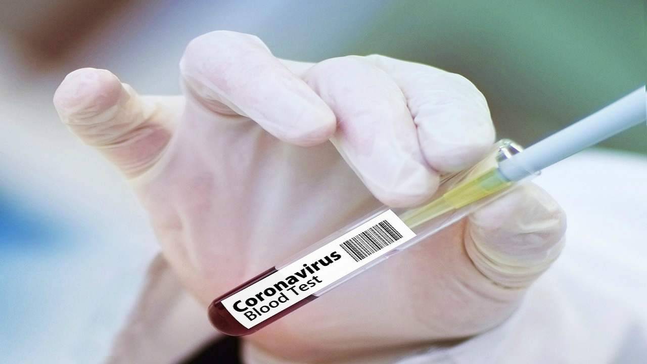 finti tamponi coronavirus