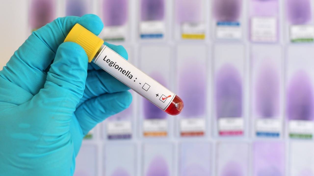 legionella policlinico Bari