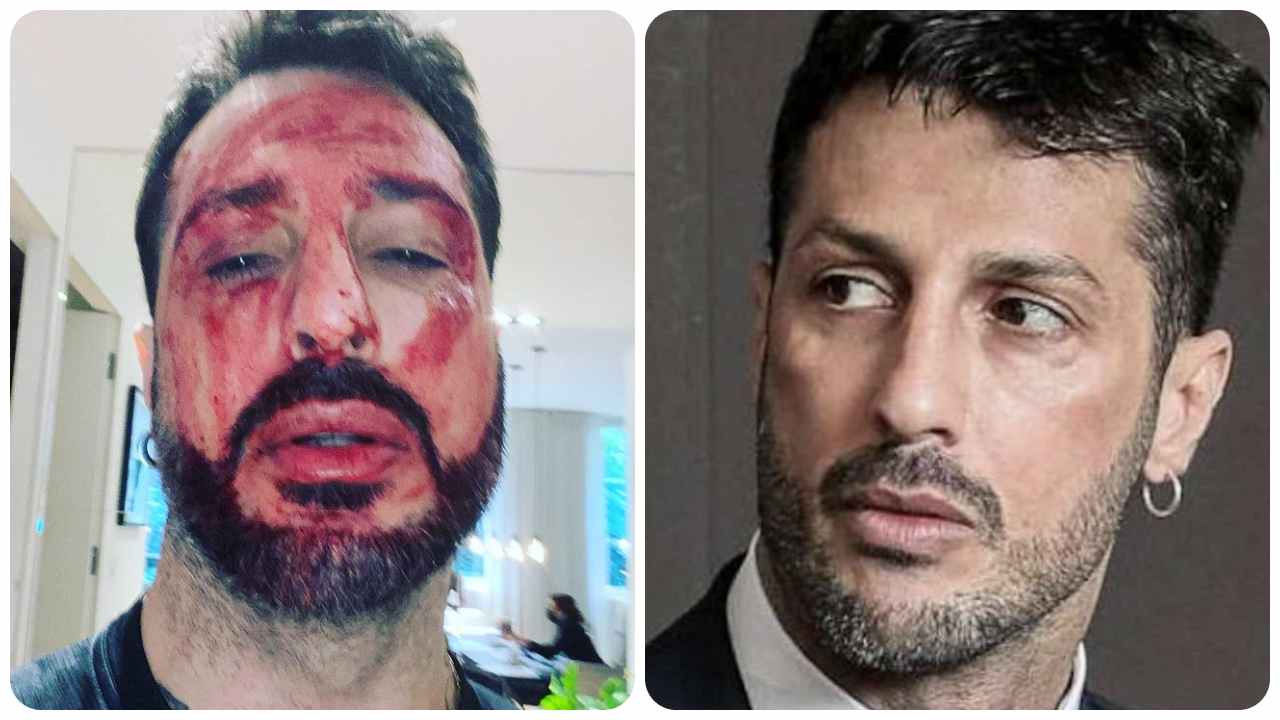 Fabrizio Corona si taglia i polsi