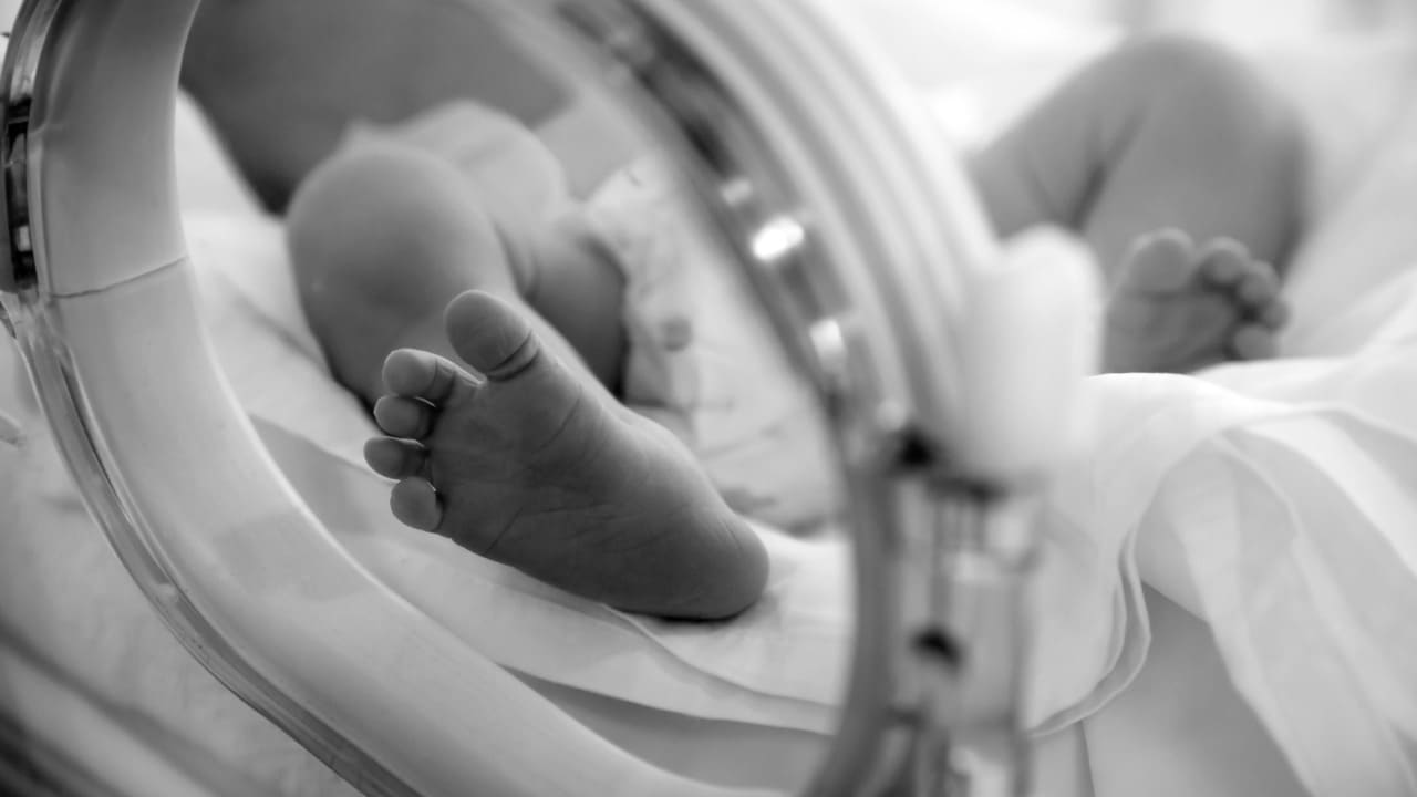neonato ustionato, migliorano condizioni