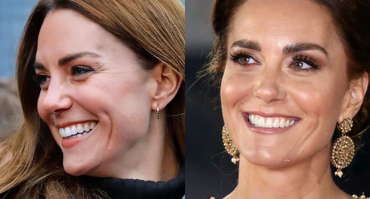 Kate Middleton prima e dopo