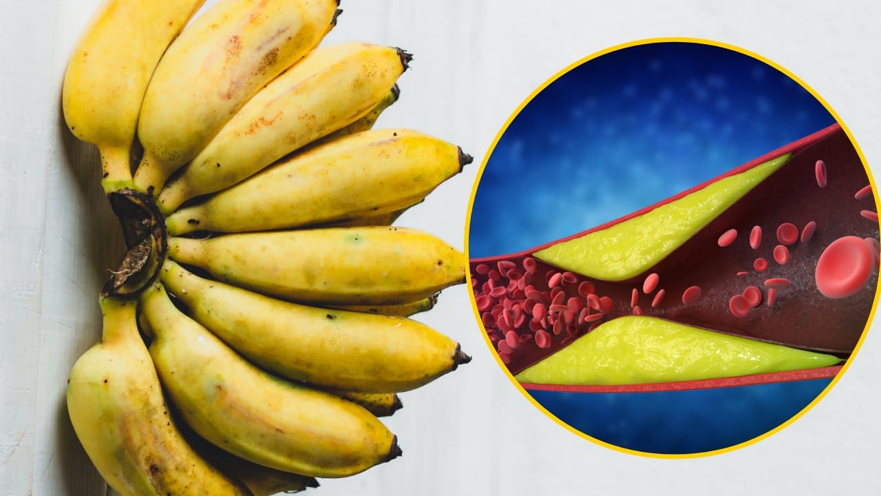 Ipercolesterolemia banane