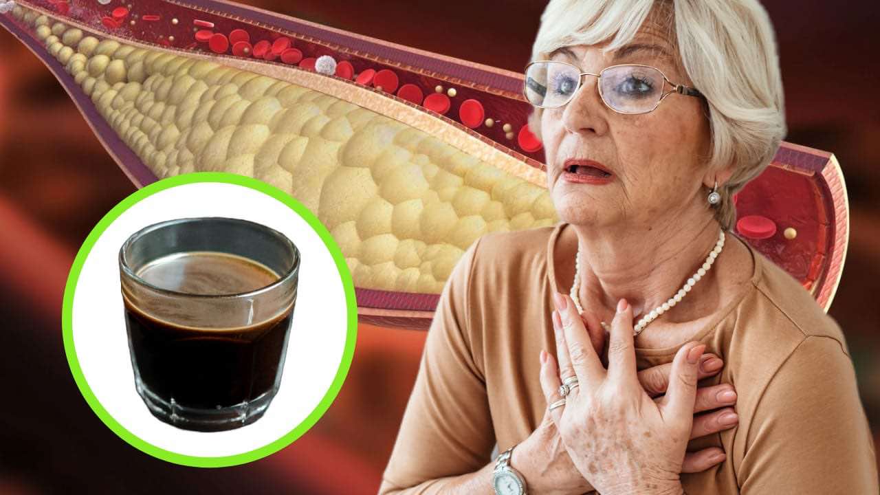 Caffè e colesterolo